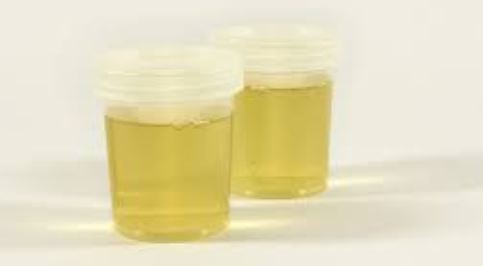 Acne to cure Urine